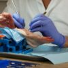 Soft-tissue management en hechttechnieken | Implant College 02