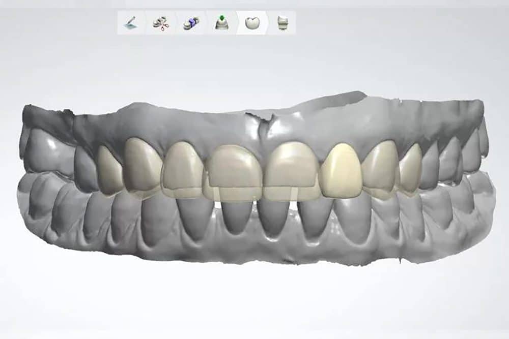 Digital Smile Design